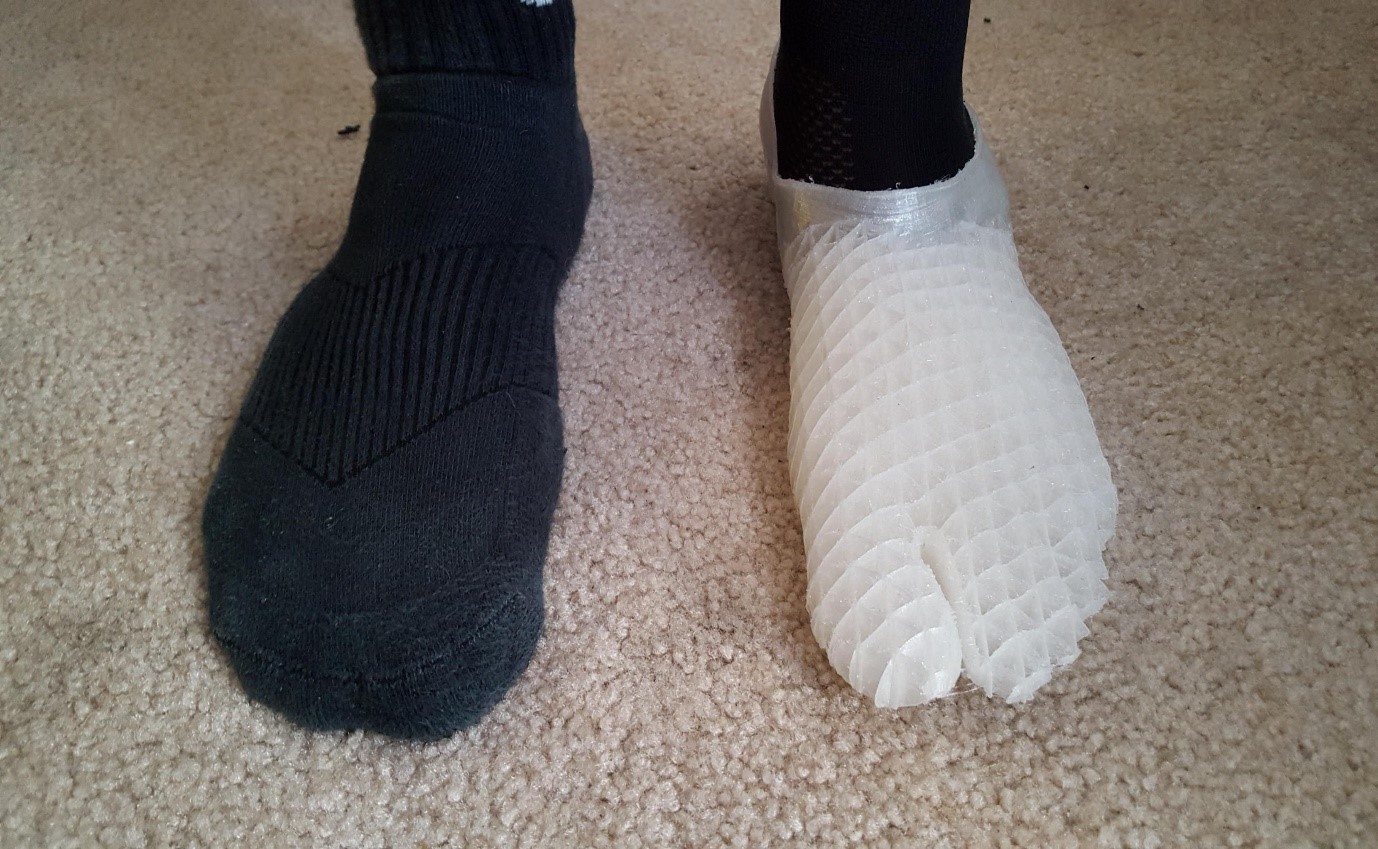 3D printed prosthetic foot
