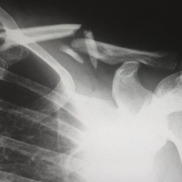 Human X-ray