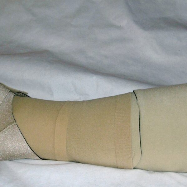 Compression therapy for lymphedema