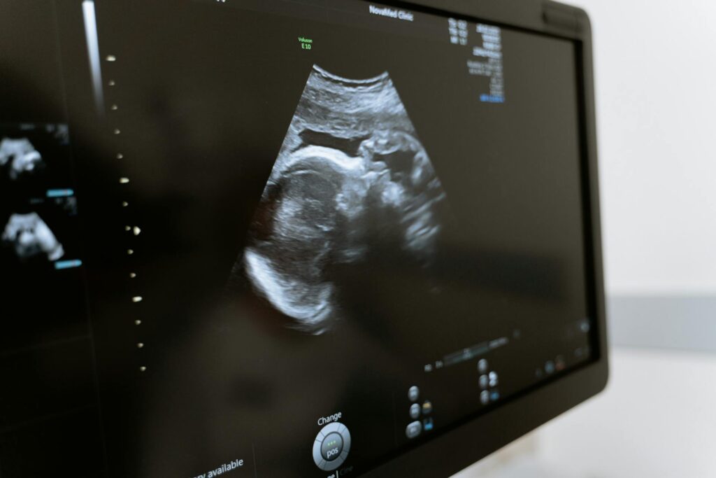 Baby scan on a monitor